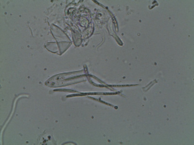 Spathularia flavida